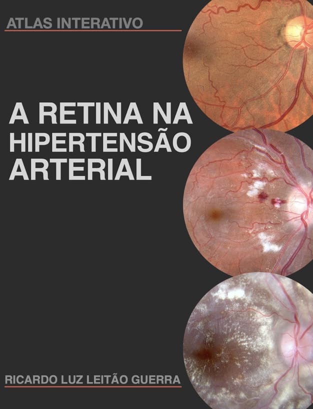 Capa do livro A RETINA NA HIPERTENSÃO ARTERIAL