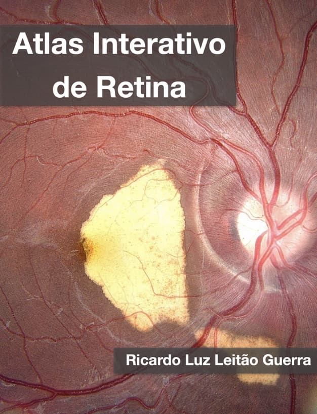Capa do livro ATLAS INTERATIVO DE RETINA