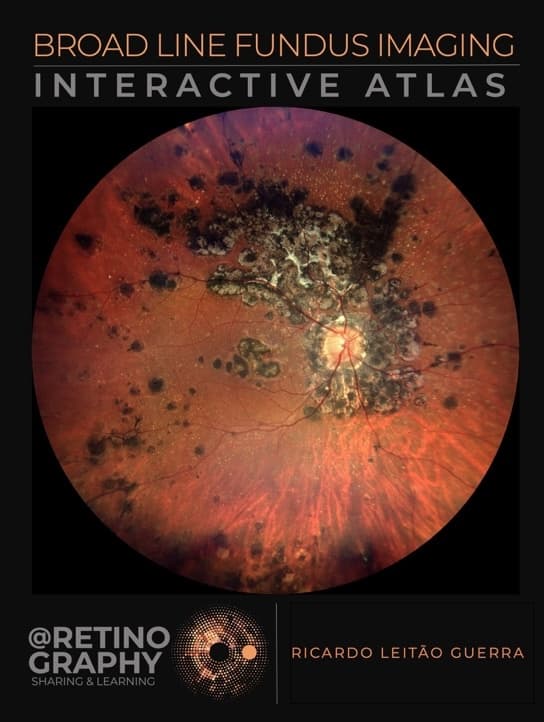 Capa do livro BROAD LINE FUNDUS IMAGING